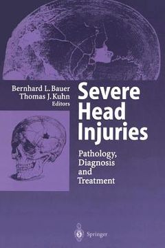 portada severe head injuries: pathology, diagnosis and treatment