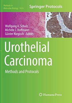portada Urothelial Carcinoma: Methods and Protocols (in English)