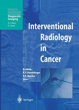 portada Interventional Radiology in Cancer (Medical Radiology) (in English)