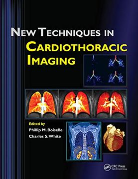 portada New Techniques in Cardiothoracic Imaging (en Inglés)