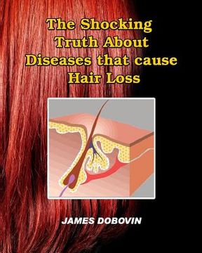 portada The Shocking Truth About Diseases that Cause Hair Loss: Secrets You Need to Know About Losing Hair So You Can Stop From Going Bald (en Inglés)