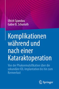 portada Komplikationen Während Und Nach Einer Kataraktoperation: Von Der Phakoemulsifikation Über Die Sekundäre Iol-Implantation Bis Hin Zum Kernverlust (in German)