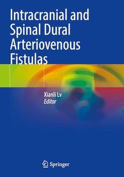 portada Intracranial and Spinal Dural Arteriovenous Fistulas (in English)