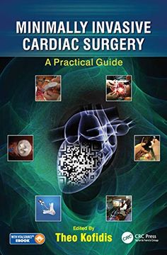 portada Minimally Invasive Cardiac Surgery: A Practical Guide (en Inglés)