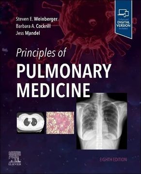 portada Principles of Pulmonary Medicine 