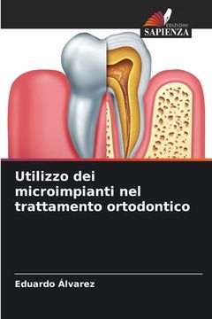 portada Utilizzo dei microimpianti nel trattamento ortodontico (en Italiano)