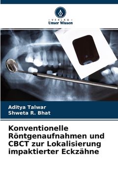 portada Konventionelle Röntgenaufnahmen und CBCT zur Lokalisierung impaktierter Eckzähne (en Alemán)