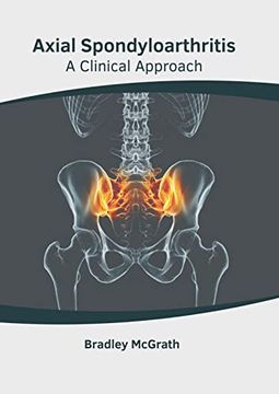 portada Axial Spondyloarthritis: A Clinical Approach (en Inglés)