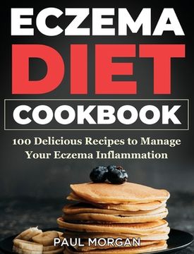 portada Eczema DIet Cookbook: 100 Delicious Recipes to Manage your Eczema Inflammation (in English)