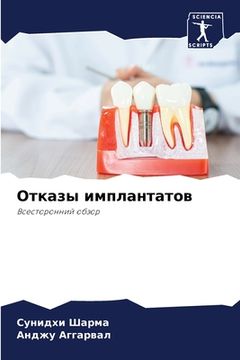 portada Отказы имплантатов (en Ruso)