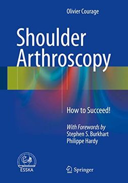 portada Shoulder Arthroscopy: How to Succeed! (en Inglés)
