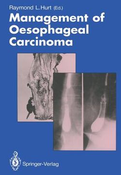 portada Management of Oesophageal Carcinoma (en Inglés)