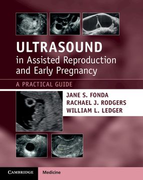 portada Ultrasound in Assisted Reproduction and Early Pregnancy: A Practical Guide (in English)