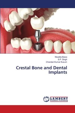 portada Crestal Bone and Dental Implants (en Inglés)