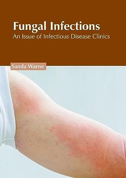 portada Fungal Infections: An Issue of Infectious Disease Clinics (en Inglés)