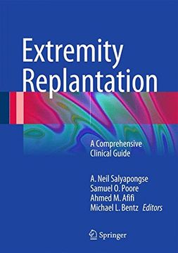 portada Extremity Replantation: A Comprehensive Clinical Guide