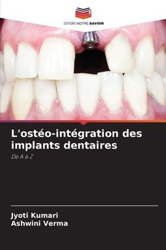 portada L'ostéo-intégration des implants dentaires (in French)