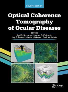 portada Optical Coherence Tomography of Ocular Diseases