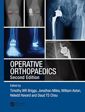 portada Operative Orthopaedics: The Stanmore Guide (en Inglés)