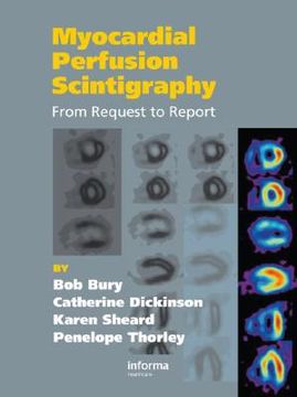 portada Myocardial Perfusion Scintigraphy: From Request to Report (en Inglés)