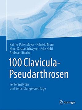 portada 100 Clavicula-Pseudarthrosen: Fehleranalysen und Behandlungsvorschläge (en Alemán)