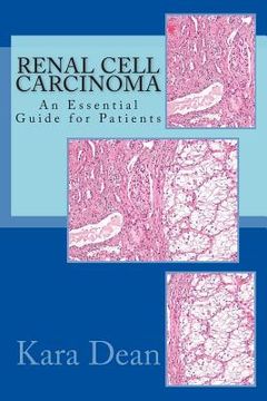 portada Renal Cell Carcinoma: An Essential Guide for Patients (en Inglés)