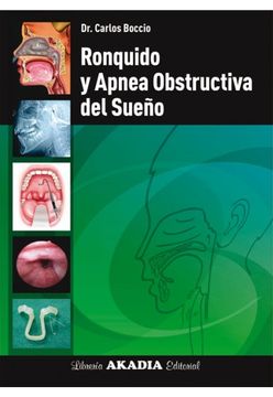 portada Ronquido y Apnea Obstructiva del Sueño (in Spanish)