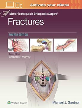 portada Master Techniques in Orthopaedic Surgery: Fractures (en Inglés)