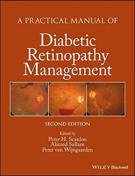 portada A Practical Manual of Diabetic Retinopathy Management (en Inglés)