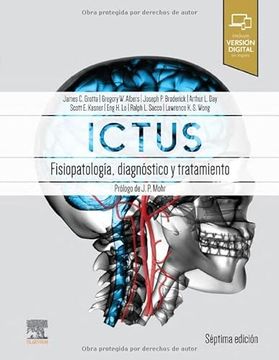 portada Ictus: Fisiopatología, Diagnóstico y Abordaje: Patofisiología, Diagnóstico y Manejo