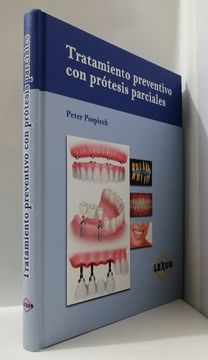 portada Tratamiento preventivo con prótesis parciales (in Spanish)