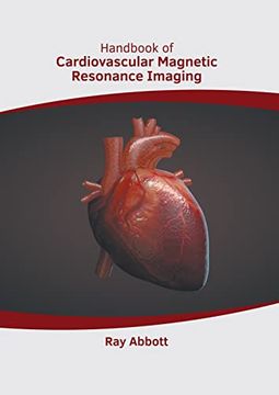 portada Handbook of Cardiovascular Magnetic Resonance Imaging (en Inglés)