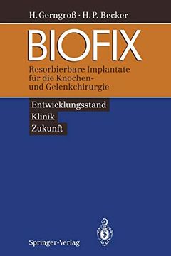 portada Biofix: Resorbierbare Implantate für die Knochen- und Gelenkchirurgie ― Entwicklungsstand, Klinik, Zukunft ― (in German)