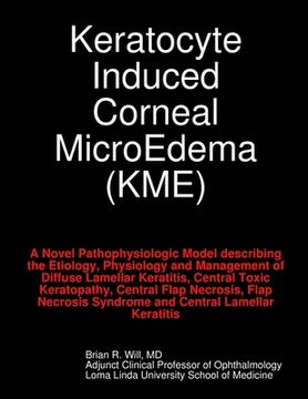 portada Keratocyte Induced Corneal MicroEdema (en Inglés)
