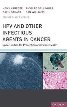 portada Hpv and Other Infectious Agents in Cancer: Opportunities for Prevention and Public Health (en Inglés)