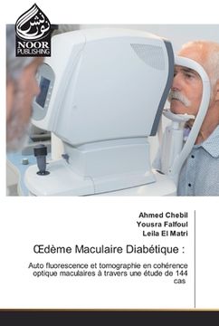 portada OEdème Maculaire Diabétique (in English)