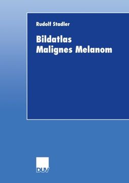 portada Bildatlas Malignes Melanom (German Edition)