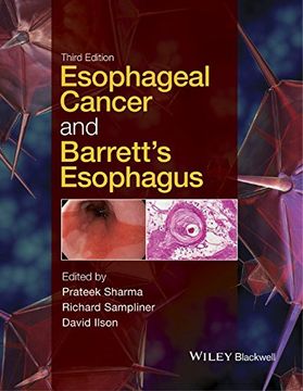 portada Esophageal Cancer and Barrett's Esophagus (en Inglés)
