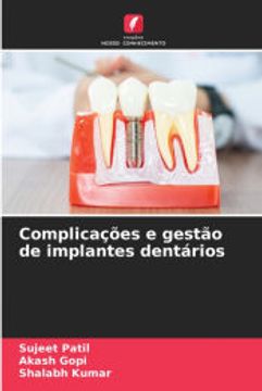 portada Complicações e Gestão de Implantes Dentários (en Portugués)