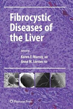 portada Fibrocystic Diseases of the Liver (en Inglés)