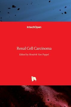 portada Renal Cell Carcinoma (en Inglés)