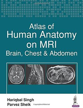 portada Atlas of Human Anatomy on MRI: Brain, Chest & Abdomen