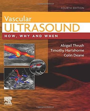 portada Vascular Ultrasound: How, why and When, 4e (en Inglés)