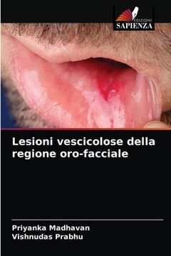 portada Lesioni vescicolose della regione oro-facciale (en Italiano)