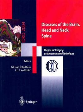 portada diseases of the brain, head and neck, spine: diagnostic imaging and interventional techniques (en Inglés)