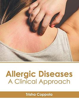 portada Allergic Diseases: A Clinical Approach (en Inglés)