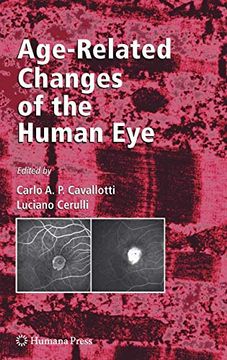 portada Age-Related Changes of the Human eye (Aging Medicine) (en Inglés)