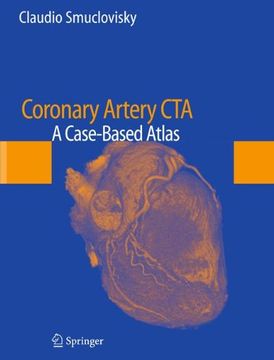 portada coronary artery cta