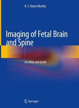 portada Imaging of Fetal Brain and Spine: An Atlas and Guide (en Inglés)