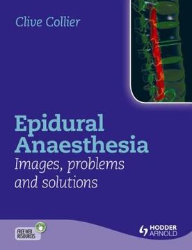 portada Epidural Anaesthesia: Images, Problems and Solutions (en Inglés)